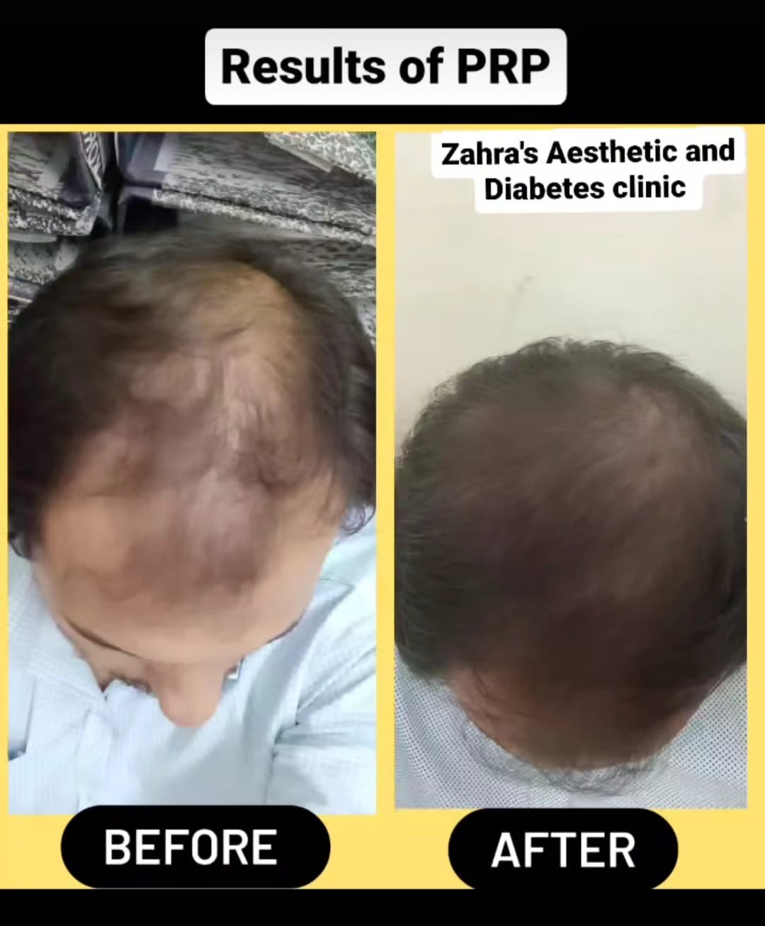 Before and after skin treatment result 1